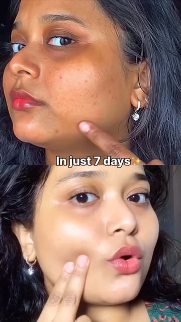 Comment “Glow” for link!
Vitamin C serum
Key Features:-