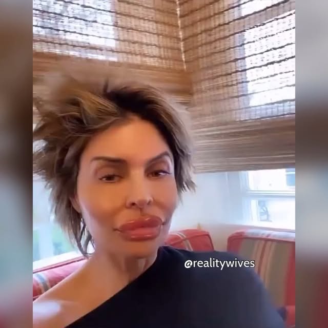 Plastic surgery victim #RHOBH star Lisa Rinna, is allegedly