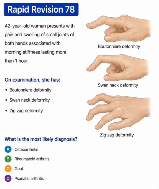 Rapid Revision 78
42-year-old woman presents with pain and